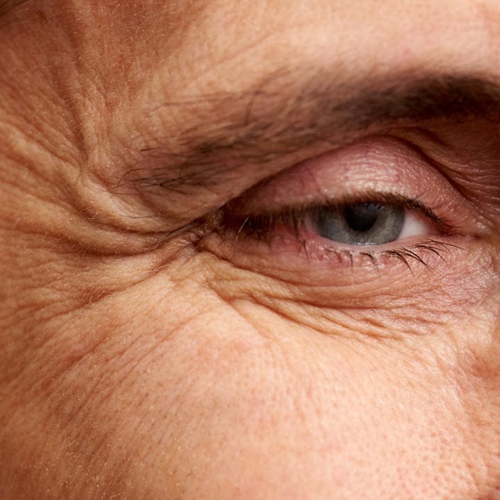 HR Plastic Sugery - Skin wrinkles What Can i do